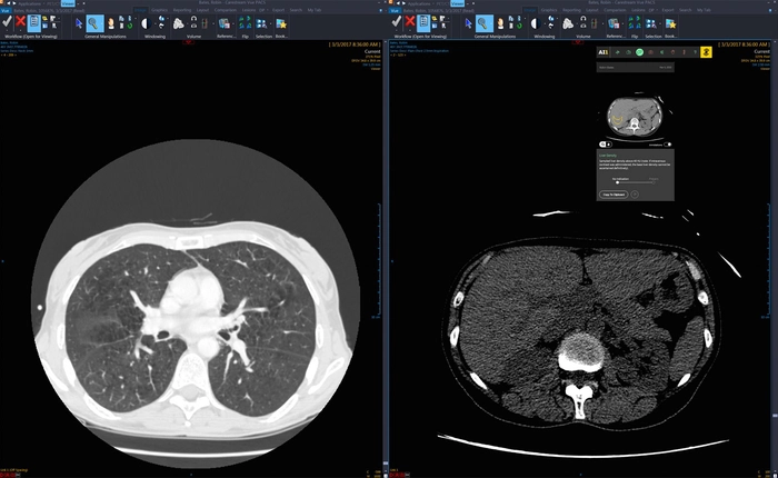 Công cụ AI giúp kiểm tra các hình ảnh quét y tế và chẩn đoán bệnh với giá chỉ 1 USD