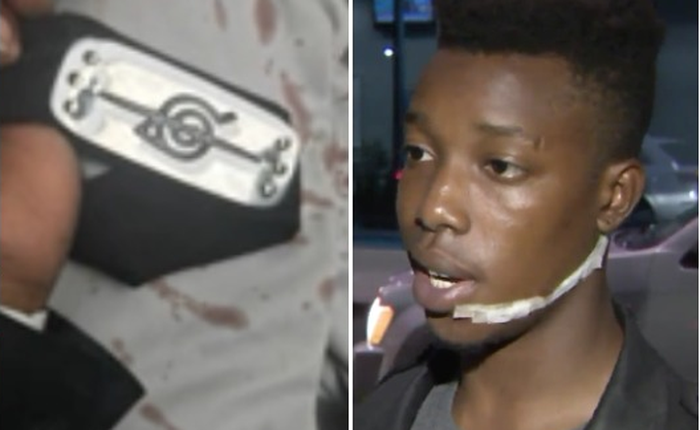 Bị tấn công bất ngờ bằng dao, chàng trai thoát chết nhờ băng buộc đầu của Itachi trong Naruto