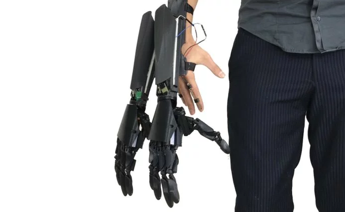 Goro 4 tay trong Mortal Kombat vẫn chưa là gì, bạn có thể trở thành người 6 tay với phát minh này