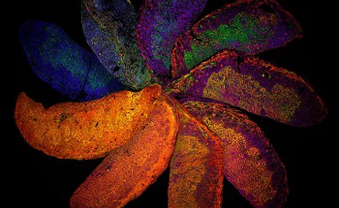 Những bức ảnh về khoa học nhưng không kém phần nghệ thuật của Giải thưởng Wellcome Image 2017