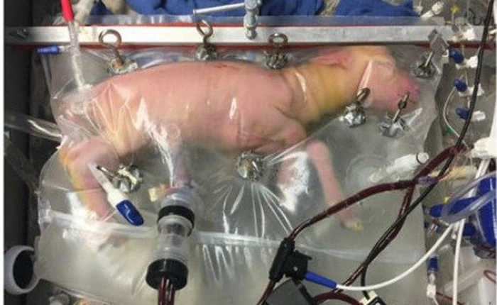 Nuôi thành công bào thai cừu trong túi dịch, trẻ em có thể phát triển bên ngoài cơ thể mẹ trong vòng 3-5 năm nữa