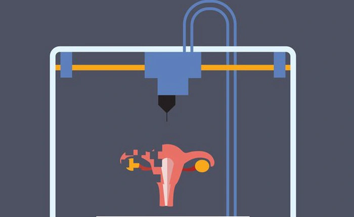 Nhiều phụ nữ vô sinh sẽ tìm lại được niềm vui làm mẹ khi công nghệ in 3D buồng trứng này phát triển thêm 5 năm nữa