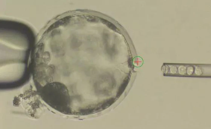 Tế bào não người siêu nhỏ được nuôi cấy trong cơ thể chuột bắt đầu cho thấy dấu hiệu phát triển