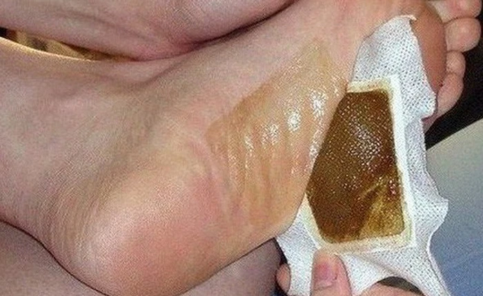 Chuyên gia vạch trần sự thật về miếng dán thải độc được quảng cáo chữa bách bệnh