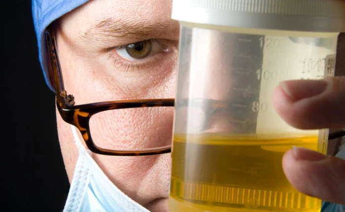 Giới công nghệ vui mừng khi tìm ra cách làm pin từ nước tiểu giá thành cực thấp, hiệu suất cao