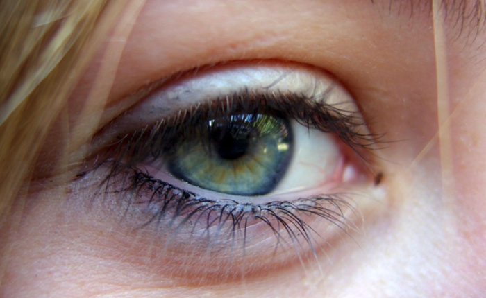 Cày game mobile 24 tiếng liên tục, một cô gái Trung Quốc đã bị mù một bên mắt