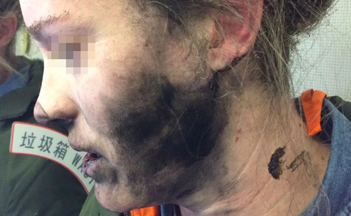 Tai nghe nổ trên máy bay, nữ hành khách bị bỏng nhẹ