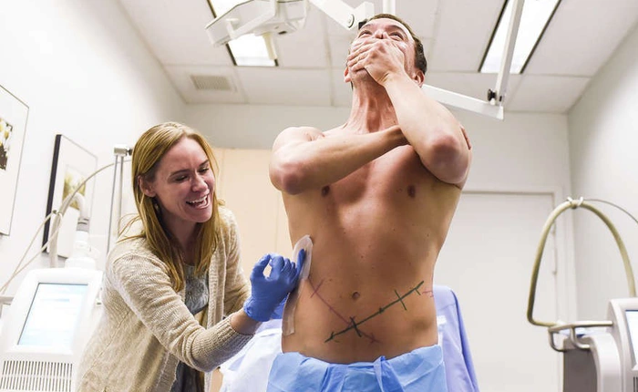 Anh chàng này đông lạnh bụng mình trong 1 giờ, 6 tuần sau mỡ thừa tự động biến mất