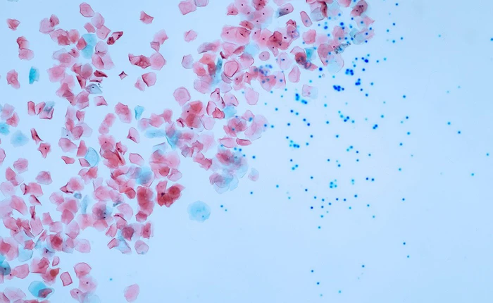 Nghiên cứu đầu tiên chứng minh cơ thể con người chúng ta đã xuất hiện hạt vi nhựa do ăn hải sản bị ô nhiễm