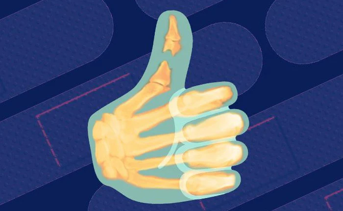 Gãy ngón chân sẽ tự khỏi mà không cần bó bột: Hóa ra đây là 5 điều mọi người hay hiểu lầm về xương