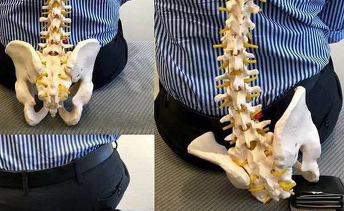 Bức ảnh này sẽ khiến bạn bỏ ngay thói quen cất ví tiền sau mông