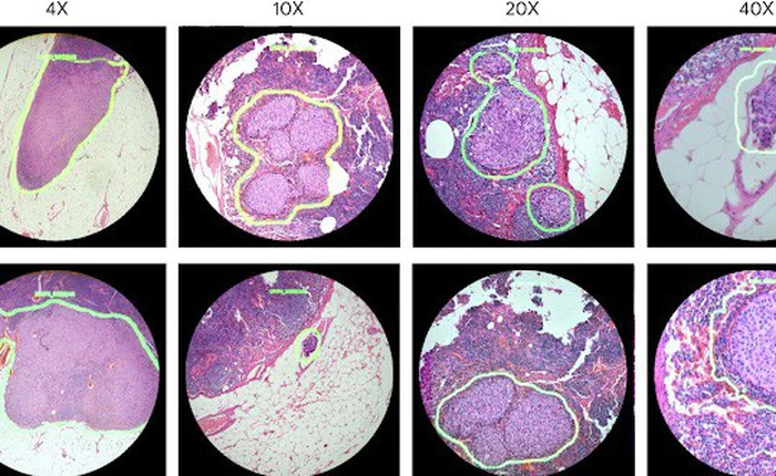 Google tạo ra một chiếc kính hiển vi tăng cường thực tại có khả năng phát hiện ung thư