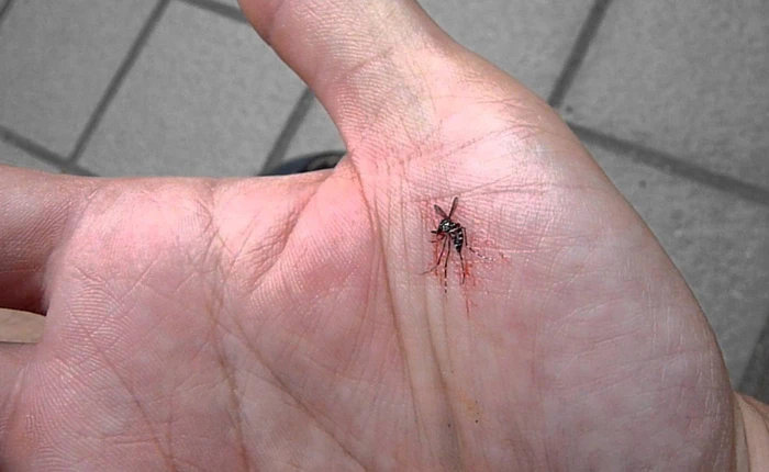 Đây là cách giảm ngứa cho vết muỗi đốt của bạn