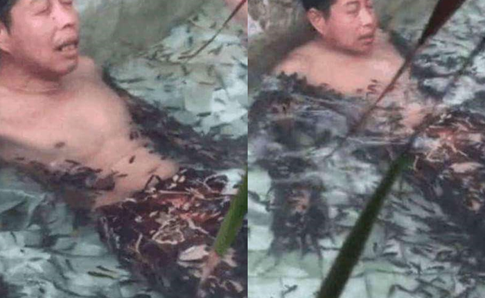 Chuyện thật như đùa: Thanh niên đi massage bằng cá, 5 phút sau cả đàn cá lăn ra chết mà không rõ nguyên nhân