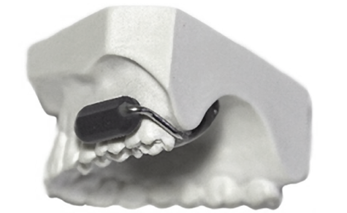 Bộ Quốc phòng Hoa Kỳ chi hàng triệu USD để phát triển điện thoại gắn vào răng