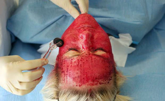 “Mặt nạ ma cà rồng”: Giới chuyên gia đang khuyến cáo người sử dụng dịch vụ cần đi xét nghiệm HIV và viêm gan