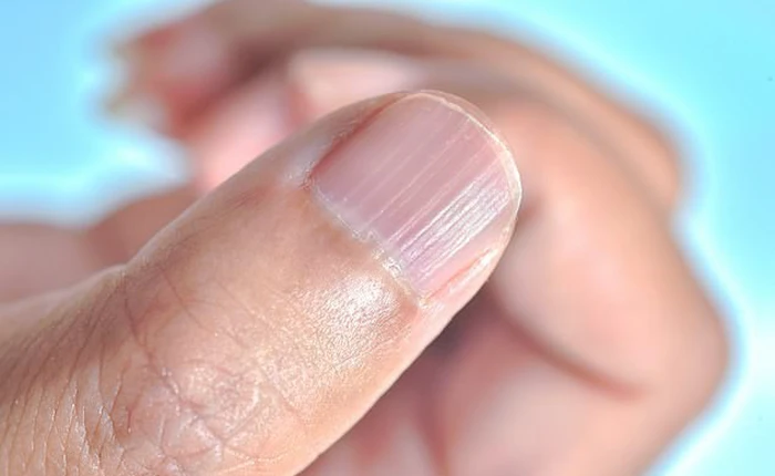 Giải mã 7 dấu hiệu bệnh lý thường thể hiện ra bên ngoài cơ thể