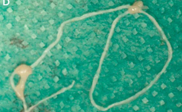 Dùng ảnh selfie để theo dõi  "giun ký sinh" di chuyển qua lại trên mặt trong 2 tuần