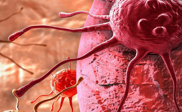 Trí tuệ nhân tạo có thể giúp các bác sĩ giải quyết vấn đề khó khăn nhất trong quá trình điều trị ung thư