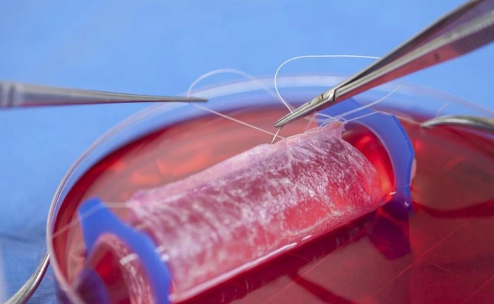 Cấy ghép tử cung, sinh con và ước mơ lớn nhất trong đời người chuyển giới - Phần 2