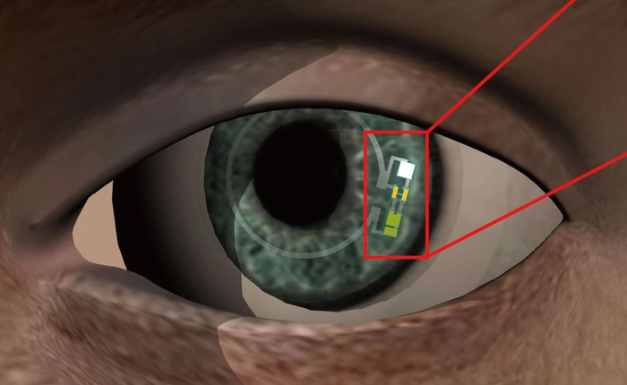 Không cần kim y tế, loại kính áp tròng "kỳ diệu này có khả năng phát hiện tiểu đường