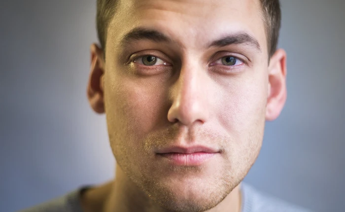 Đây là cách bạn có thể đoán được ai đó bị ốm, chỉ cần nhìn vào sắc mặt