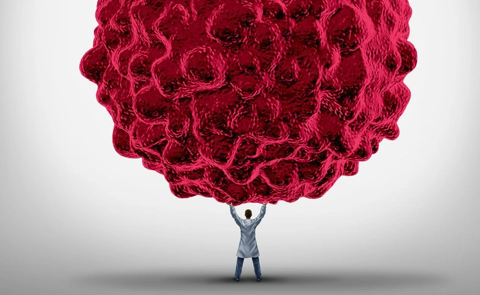 Ung thư bây giờ không có nghĩa là cái chết, chúng ta phải thay đổi ngay quan niệm đó