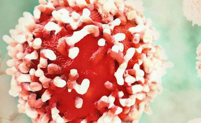 [Đọc nhanh] 10 điều quan trọng ai cũng nên làm ngay để ngăn ngừa nguy cơ mắc ung thư