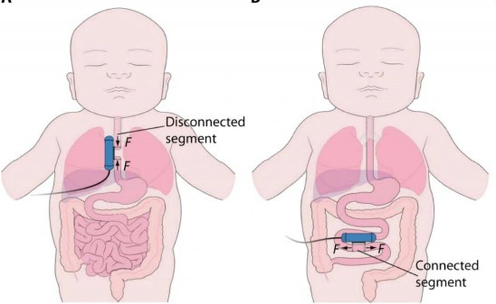 Các nhà khoa học muốn thả robot vào trong cơ thể người để chữa bệnh