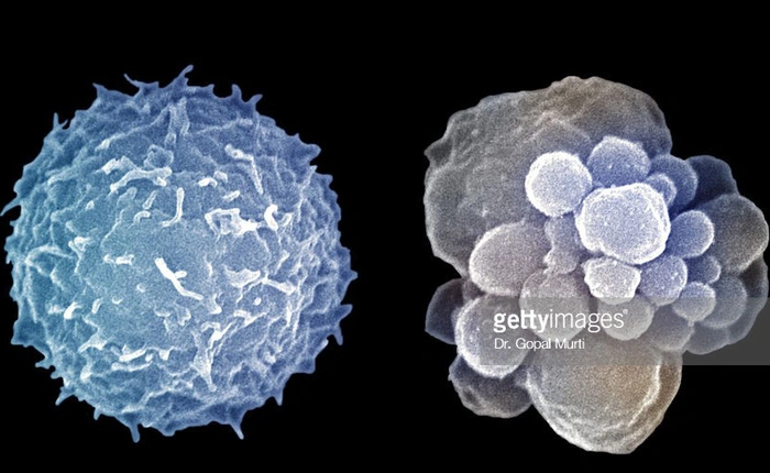 Hợp chất có trong rau và thuốc hóa trị làm chậm quá trình lão hóa, giúp chuột tăng được 36% tuổi thọ