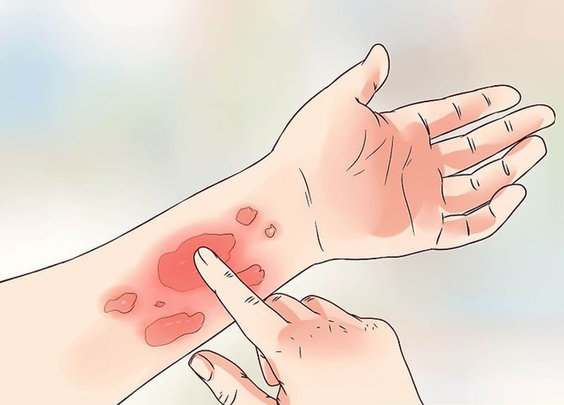 Hà Nội lại mưa dài ngày, cẩn thận quần áo ngấm mưa có thể gây ra 4 vấn đề sức khỏe tai hại sau - Ảnh 2. Hà Nội lại mưa dài ngày, cẩn thận quần áo ngấm mưa có thể gây ra 4 vấn đề sức khỏe tai hại sau - Ảnh 2.