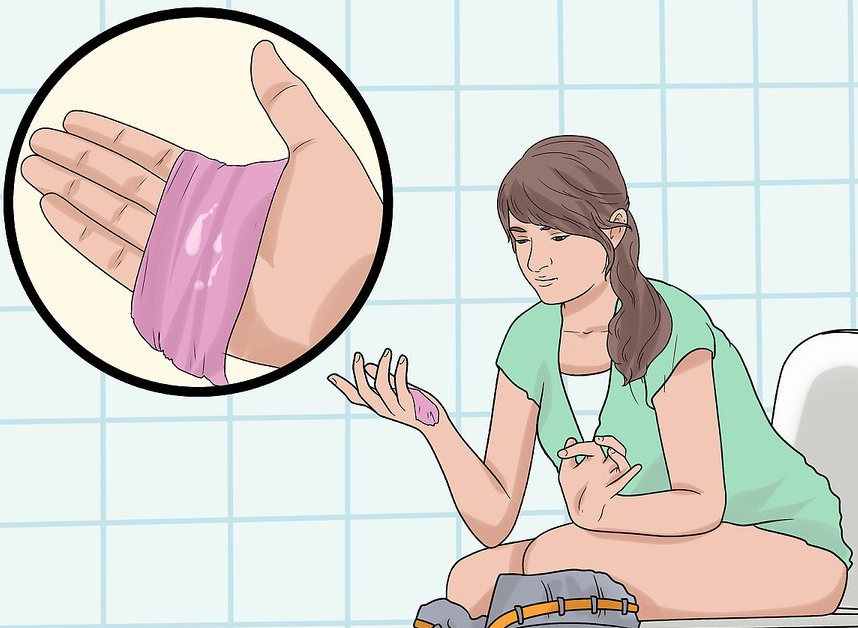 Kh&iacute; hư tiết ra c&oacute; m&agrave;u sắc kh&aacute;c lạ đang ngầm cảnh b&aacute;o những căn bệnh phụ khoa n&agrave;o? - Ảnh 2.