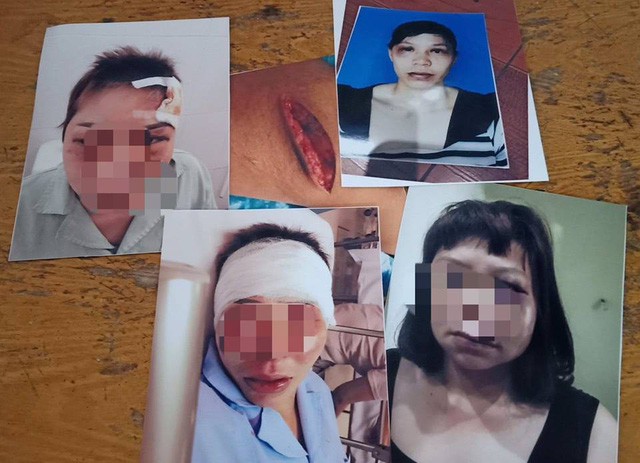 Vụ nữ nh&acirc;n vi&ecirc;n hộ l&yacute; bị chồng bạo h&agrave;nh: Đối tượng khai g&igrave; với cơ quan c&ocirc;ng an? - Ảnh 2.